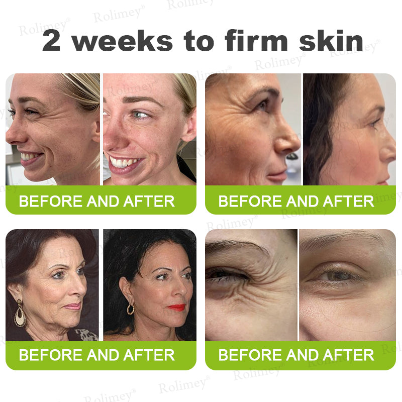 🍃Rolimey®Wrinkle-Lift Tightening stick