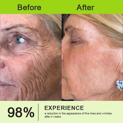 🍃Rolimey®Wrinkle-Lift Tightening stick