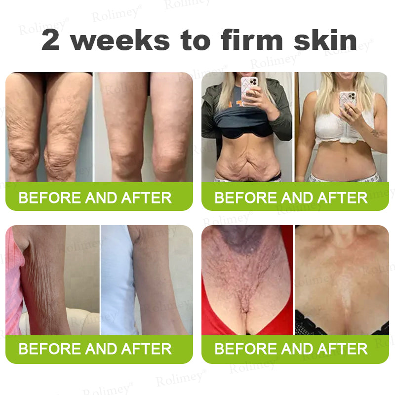 🍃Rolimey®Wrinkle-Lift Tightening stick