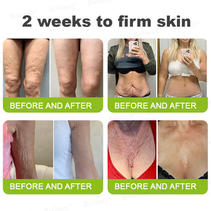 🍃Rolimey®Wrinkle-Lift Tightening stick